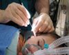 Gynecomastia Surgery Albany NY ⏬⏬